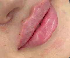 Косметолог с медицинским образованием Гулзира Абдирасулова