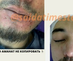 ХИДЖАМА, КОСМЕТОЛОГИЯ, МАССАЖ