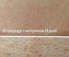 Косметолог +79257992418