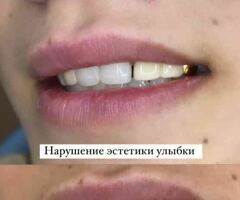 Тажрыйбалуу стоматолог Санжар Айтибаев