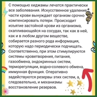 Хиджама сунна