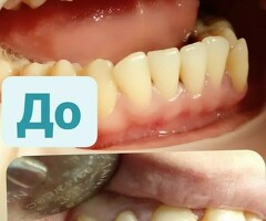 АКЦИЯ-25%ДО 20 МАРТА